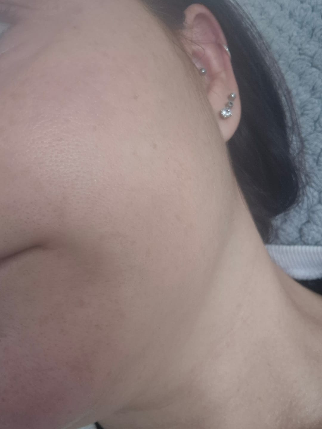 Customer photo review of The Naked Skin™ Collagen Jelly Cream