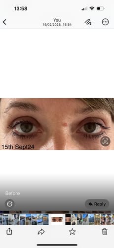 Customer photo review of iGlow Lash Maximizer - Lash Serum, 3 ml