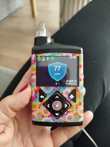 Customer photo review of Medtronic MiniMed Stickers - Summer Edition