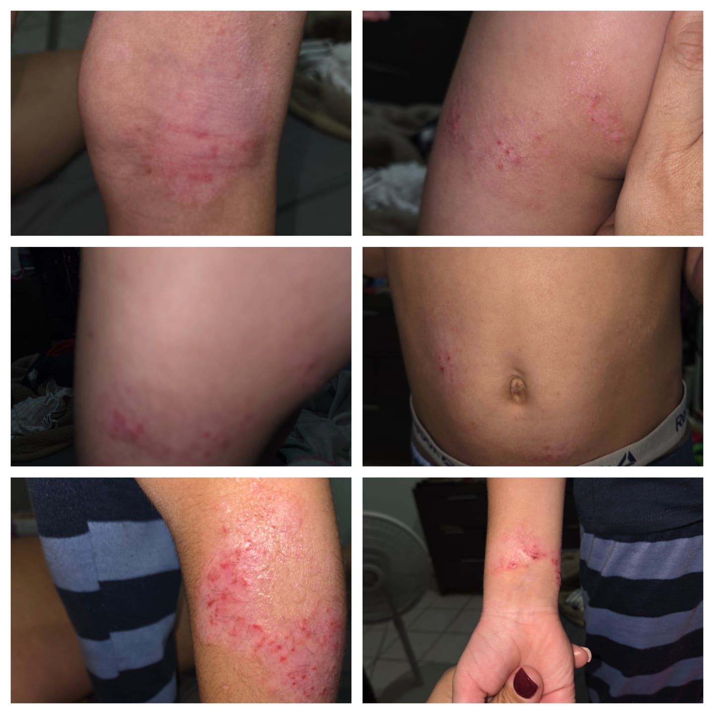 Customer photo review of Flare Up Free Bundle