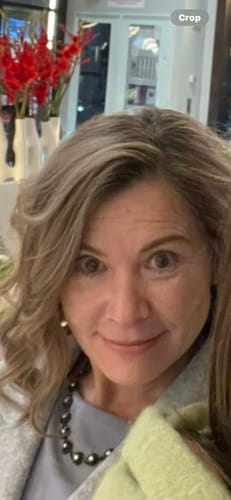 Customer photo review of F-Balm - Premium Anti-aging Tallow Balm - 2 oz.