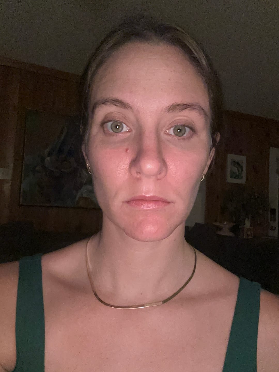 Customer photo review of CeméCalm Balm by VIMVY™