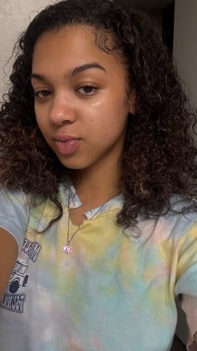 Customer photo review of 2in1 Double Cleansing Bar | Half Discoloration Brightening corrector | Half Oat Relief Acne Exfoliant