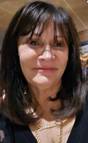 Customer photo review of F-Balm - Premium Anti-aging Tallow Balm - 2 oz.