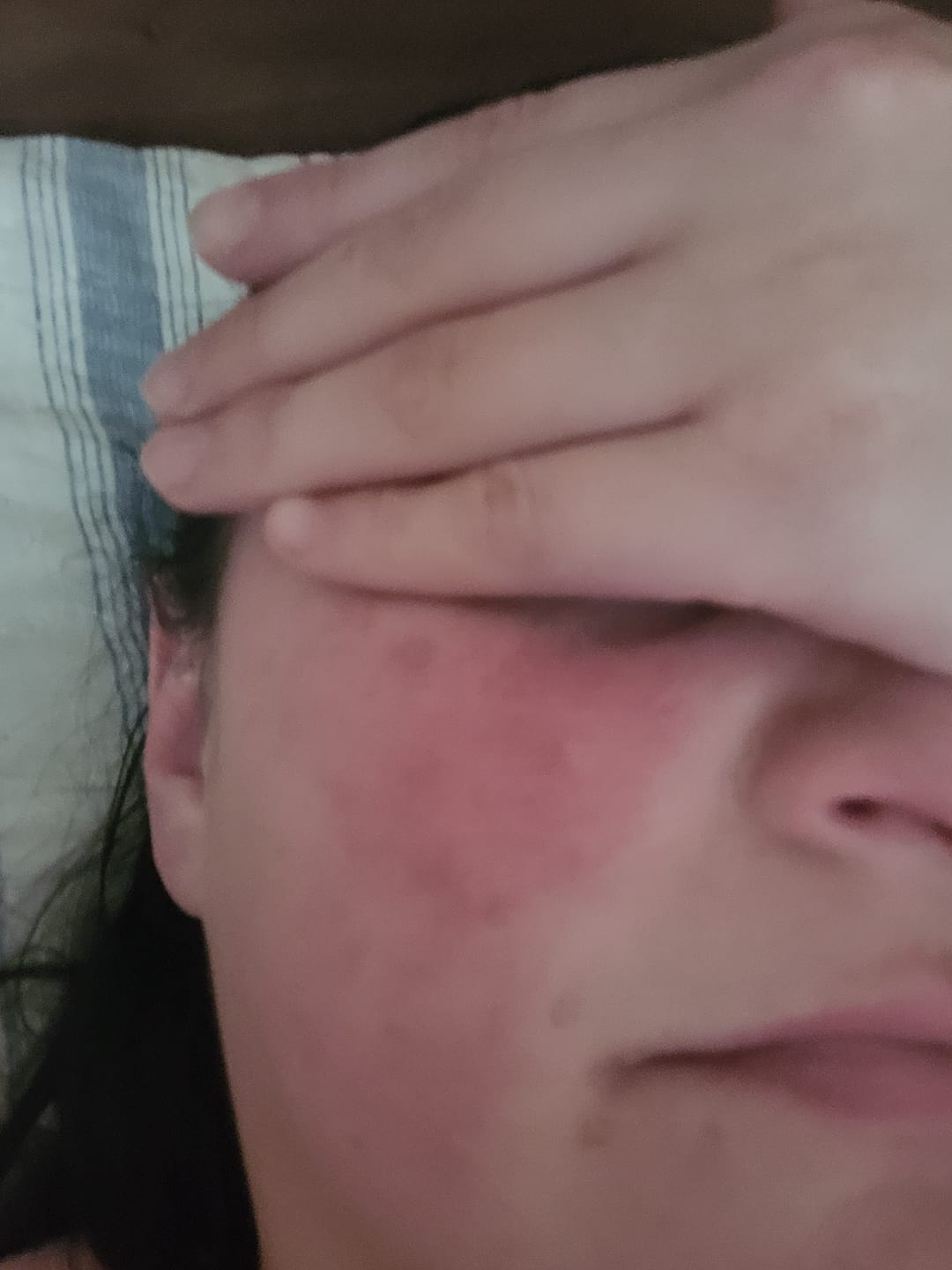 Customer photo review of Delicate Touch | Emulsión Recuperadora | Calmante