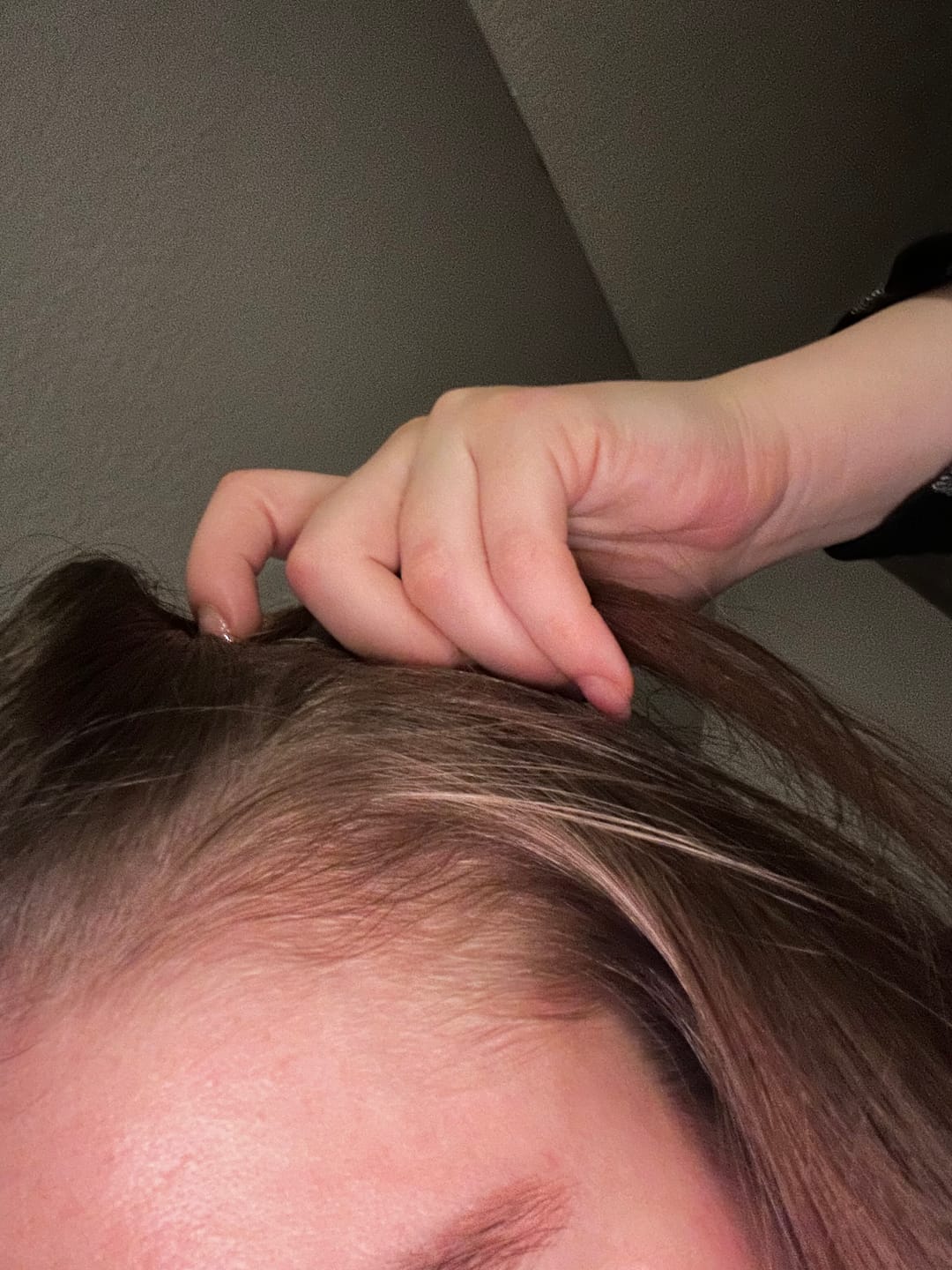 Customer photo review of HAIR GROWTH DUO
