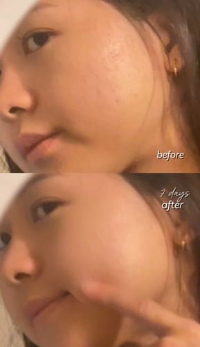 Customer photo review of Gold Radiance Serum