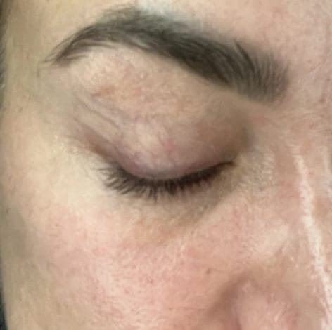 Customer photo review of Toplash eyelash and eyebrow growth serum — 3ml