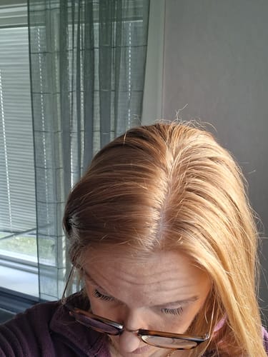 Customer photo review of Sunkissed Starter Kit