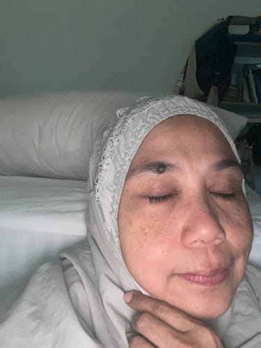 Customer photo review of Gold Radiance Serum