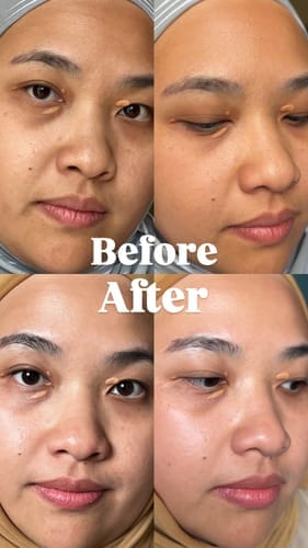 Customer photo review of Gold Radiance Serum