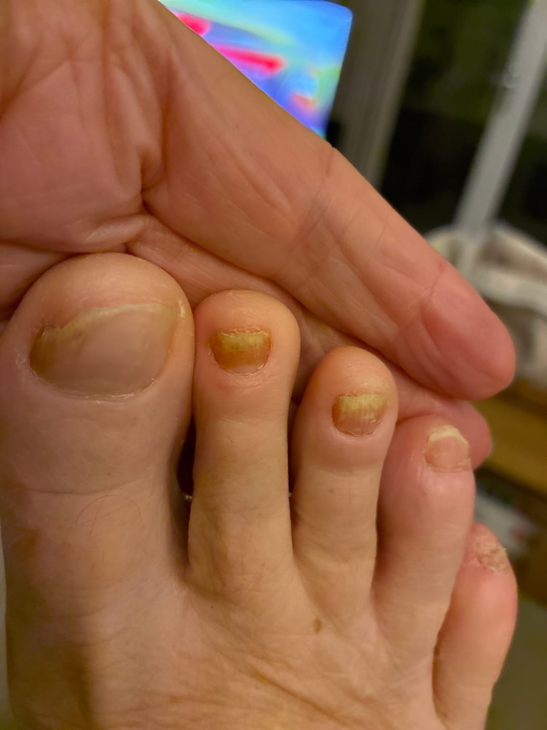 Customer photo review of Fungal Freedom