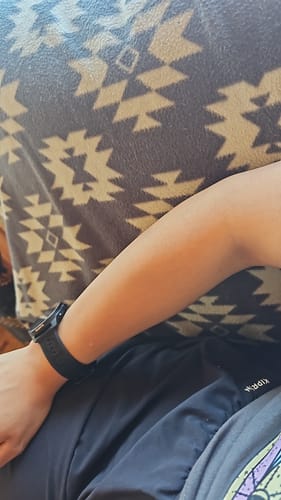 Customer photo review of Depilador Nano Pro