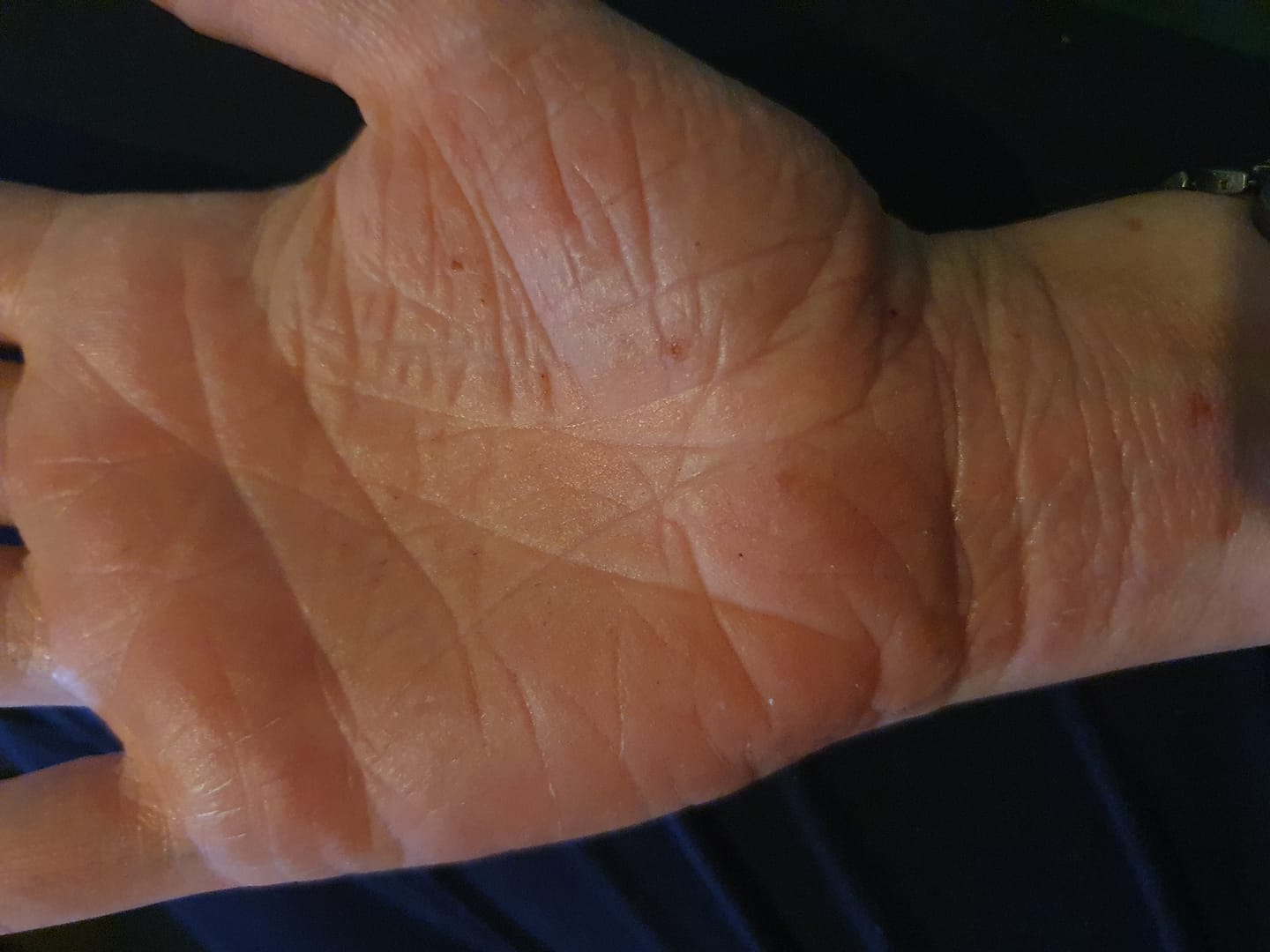 Customer photo review of Bioskin Duo Pack
