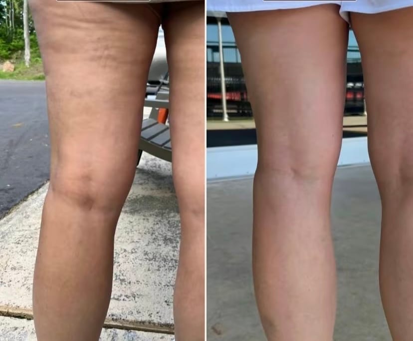 Customer photo review of CollaGlow - 30 Tage Kollagen-Kur