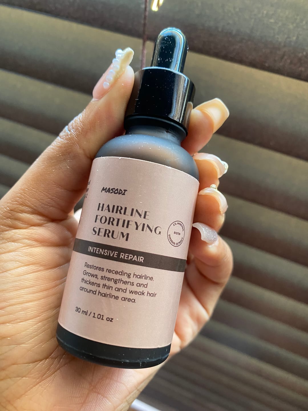 Customer photo review of Hairline Fortifying Serum 30ml - Minoxidil