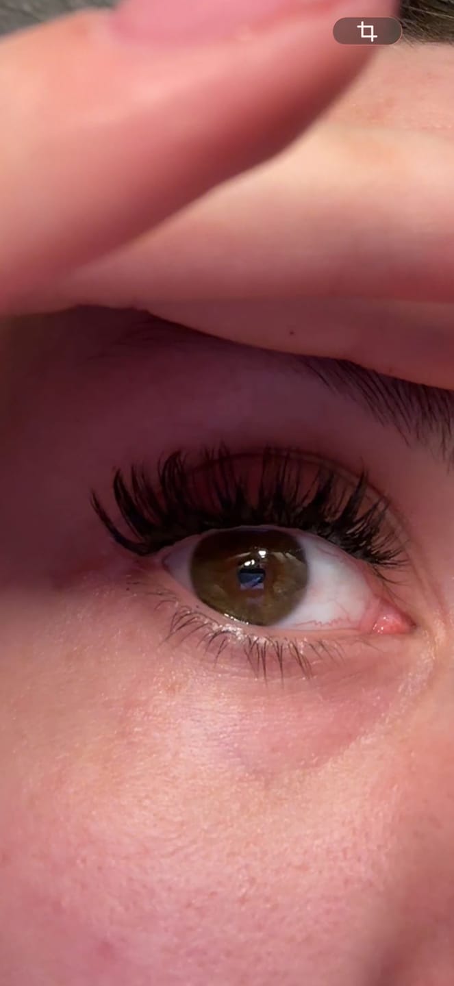 Customer photo review of NO FILTER STARTER KIT (12mm-14mm)