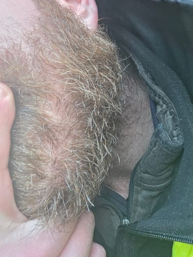 Customer photo review of Seb Natural Calming Serum