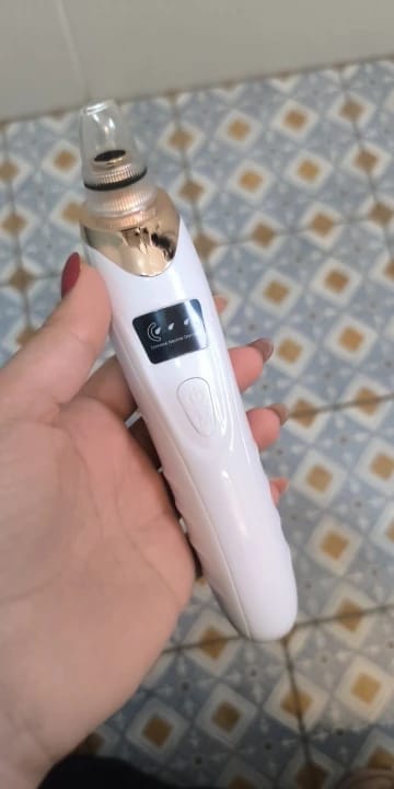 Customer photo review of Porify Mee-Eter Verwijderaar