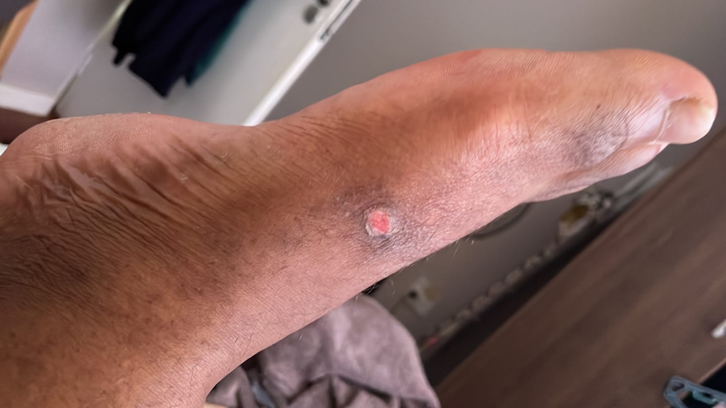 Customer photo review of ZIZI 3.0 CRAZY BLACK