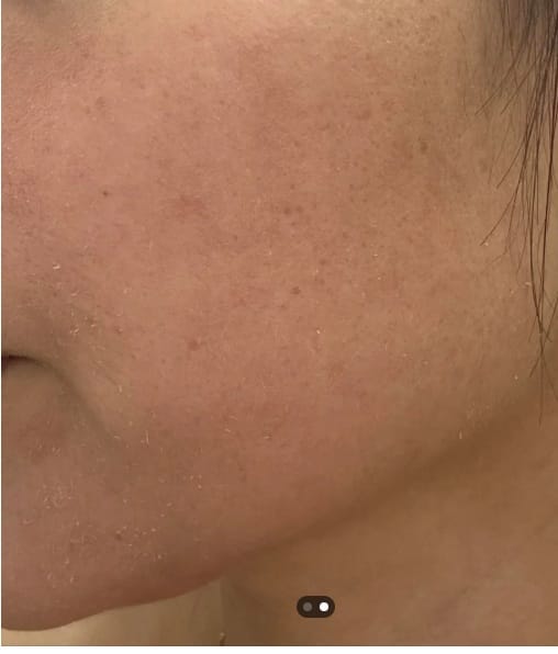 Customer photo review of Ageless AHA Glow Concentrate