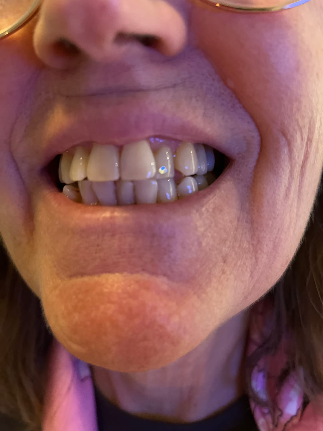 Customer photo review of Crystal Clear 1.8mm - 6-pack