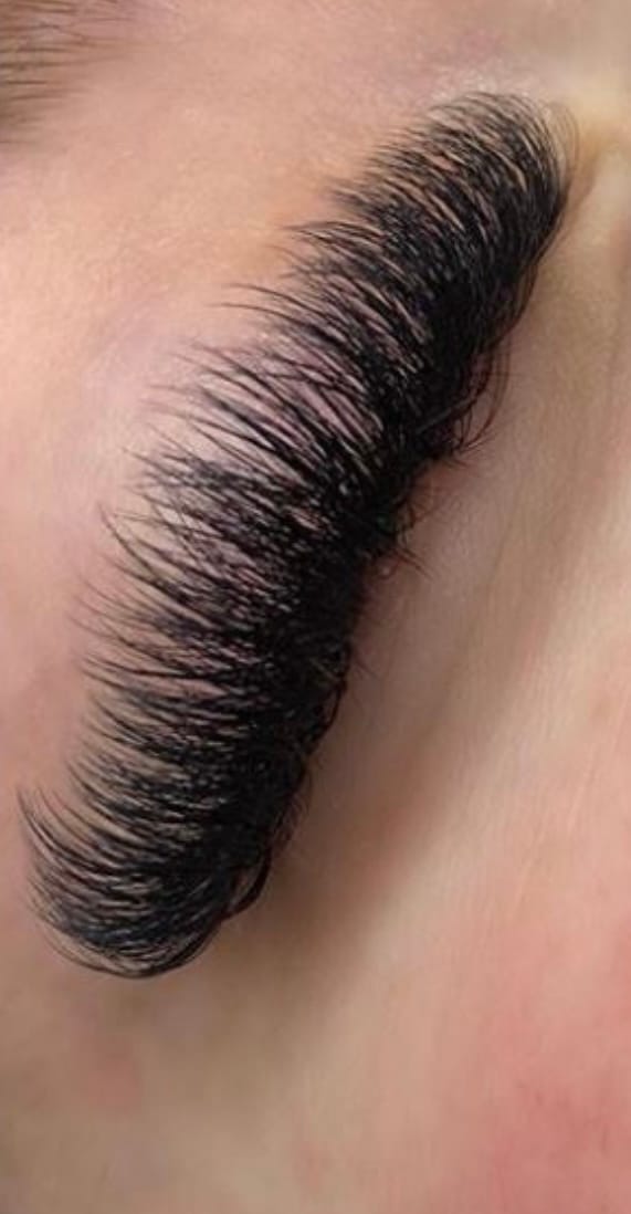 Customer photo review of NO FILTER STARTER KIT (12mm-14mm)