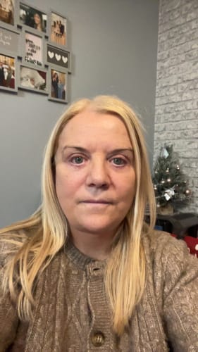 Reviewer shows how the blonde hair care blended her gray roots with her existing hair color.