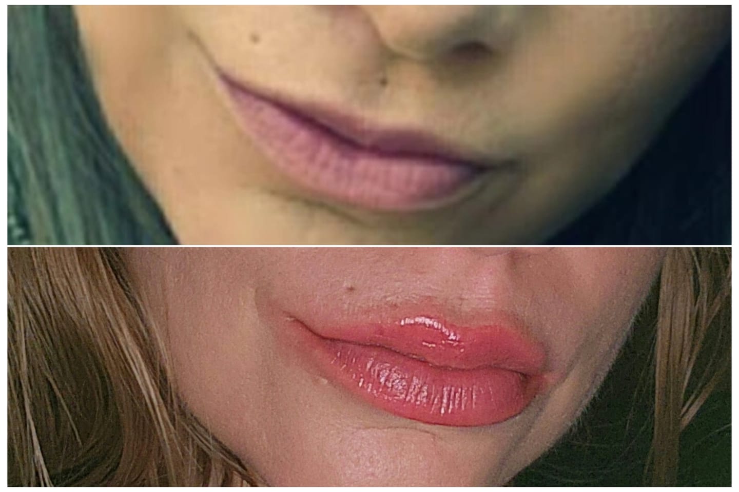 Customer photo review of Premium Korean Lip Plumper