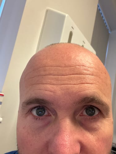 Customer photo review of Seb Natural Calming Serum