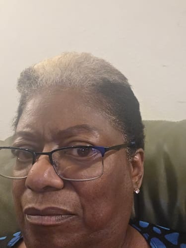 Close-up of a reviewer's hair, showing a white patch at the hairline that a dye failed to cover.