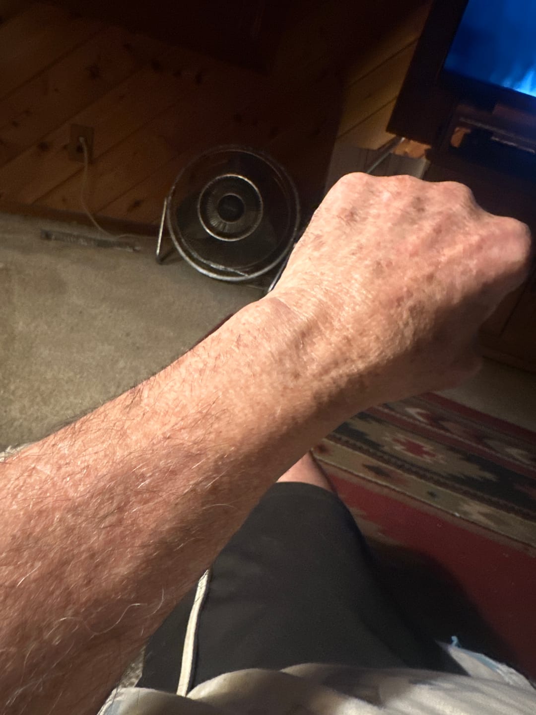 Customer photo review of Bumzzy Butt Shaver 2.0