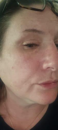 Customer photo review of The Naked Skin™ Bounce Balm