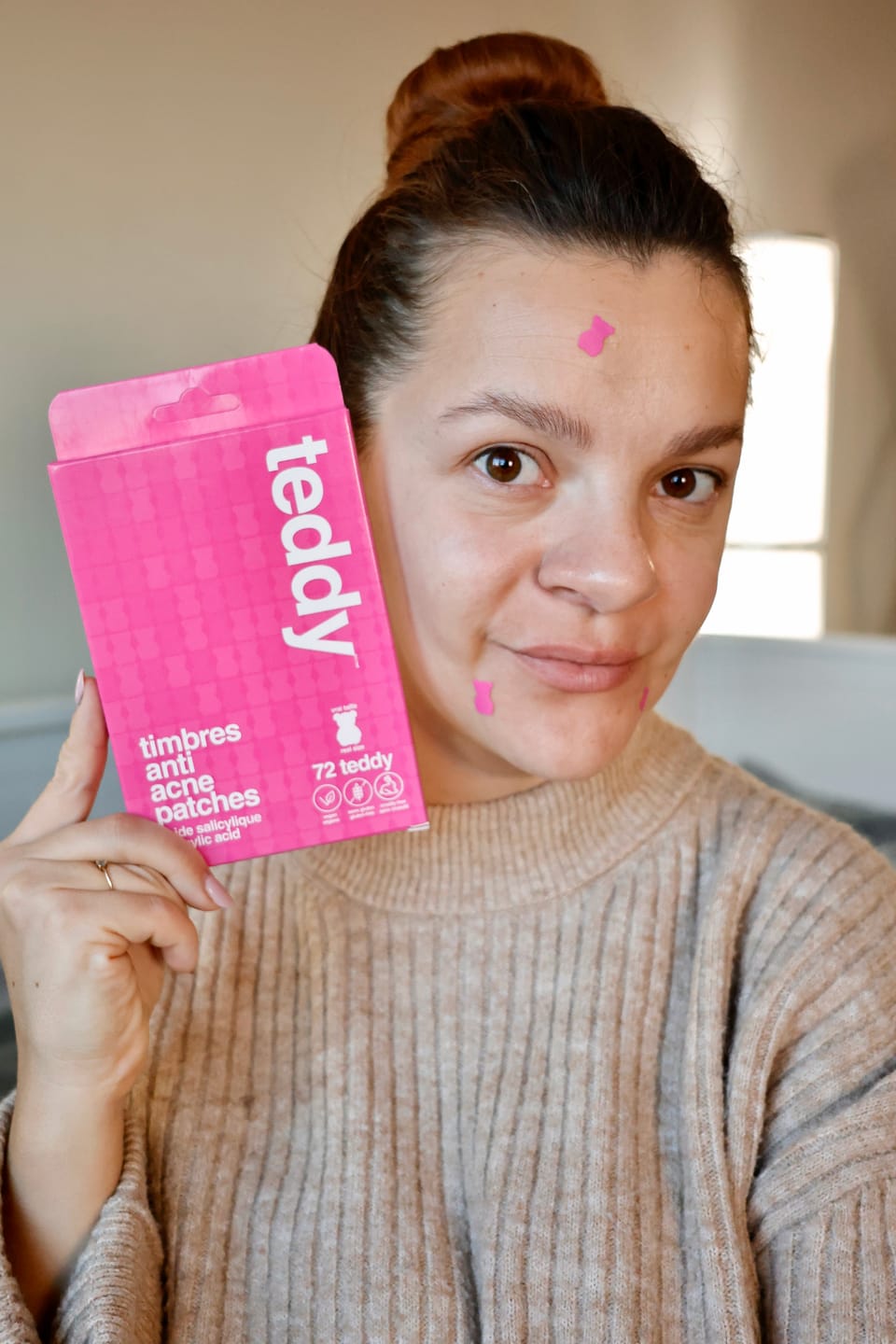 Customer photo review of Pimple Patches with Salicylic Acid - 72 Pink Teddies