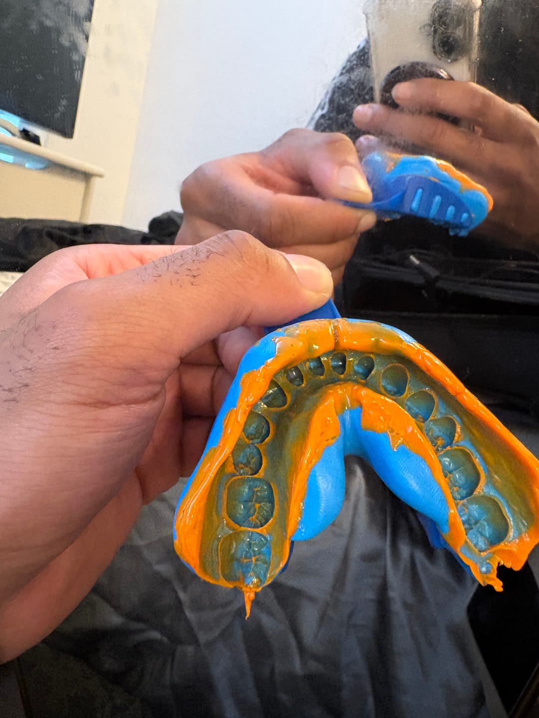 Customer photo review of Upper & Lower Impression Kit
