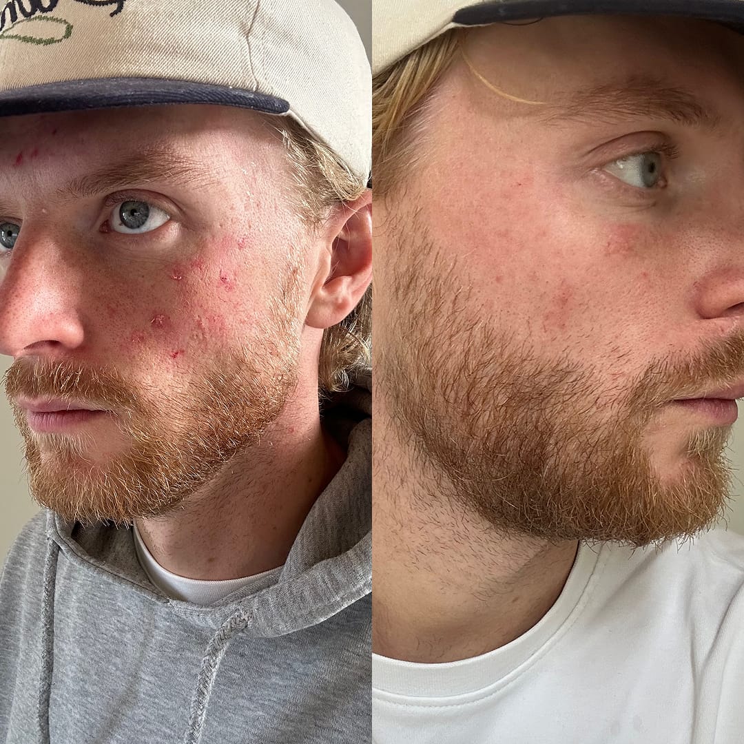 Customer photo review of CONCEALING CREAM+