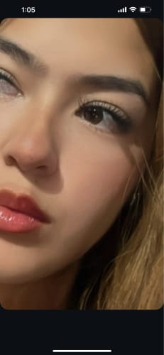 Customer photo review of InstaLift Kollagen Lippenmaske 2.0
