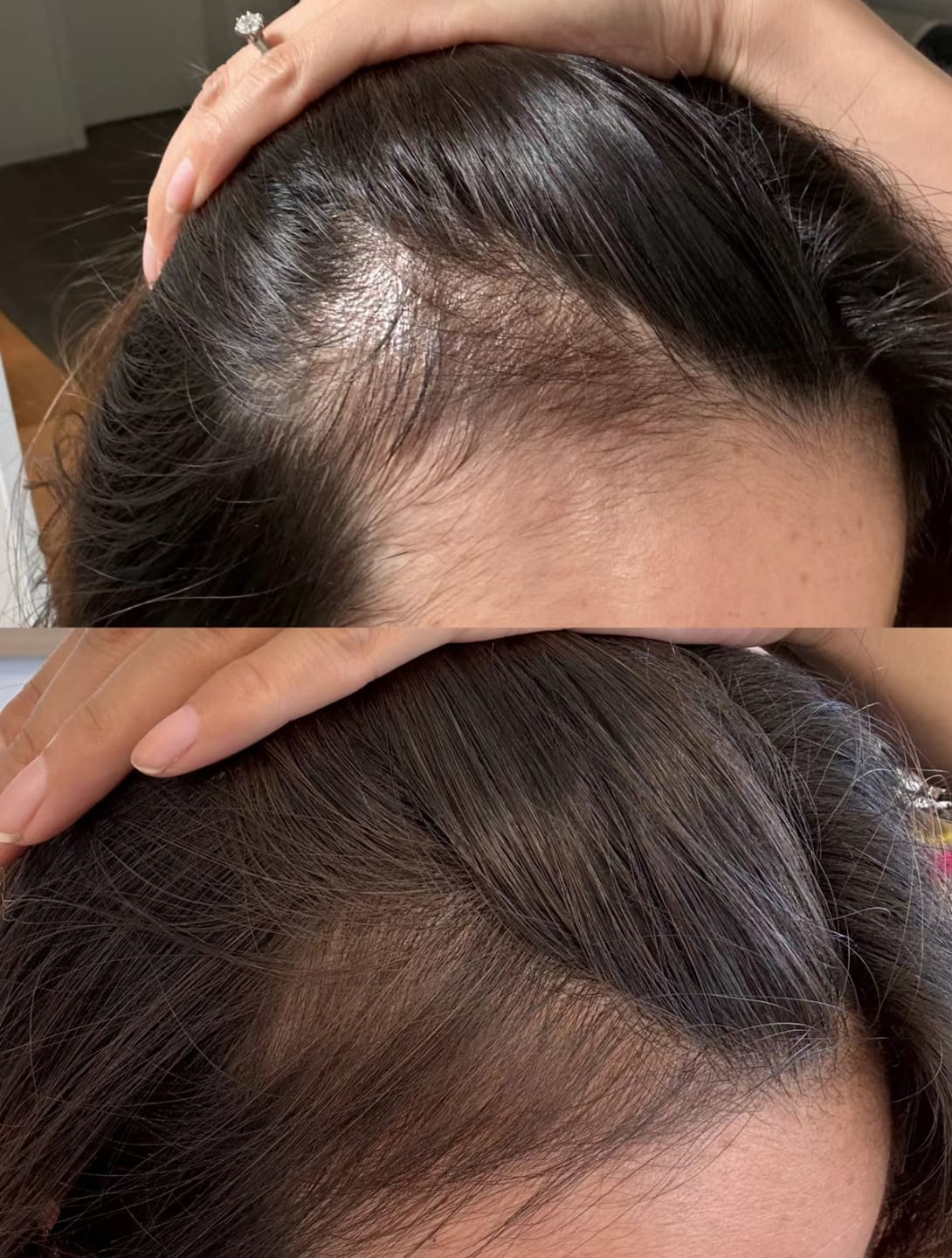 Customer photo review of [ SMIB ] -LactoBio Shampoo >Anti Frizz & Repair Series