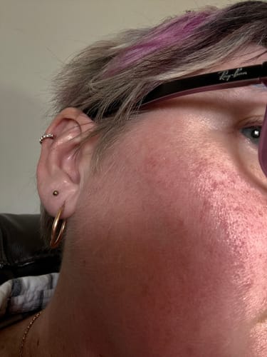 Close-up of a reviewer's ear wearing the Rose Gold Khaleesi Clustered Hoop in their helix piercing.