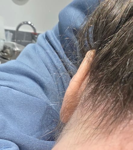 Customer photo review of Seb Natural Calming Serum