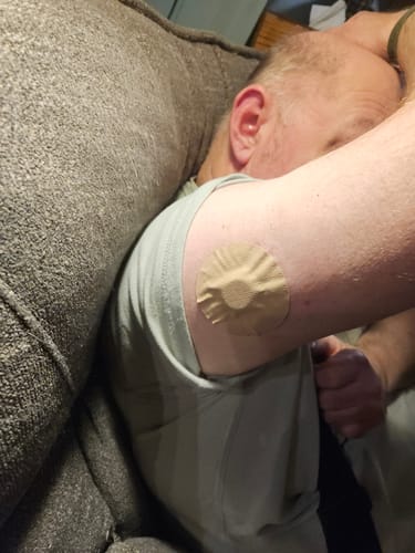 Customer photo review of Skin Grip MAX Dexcom G7 & Stelo Patches - 10 Pack