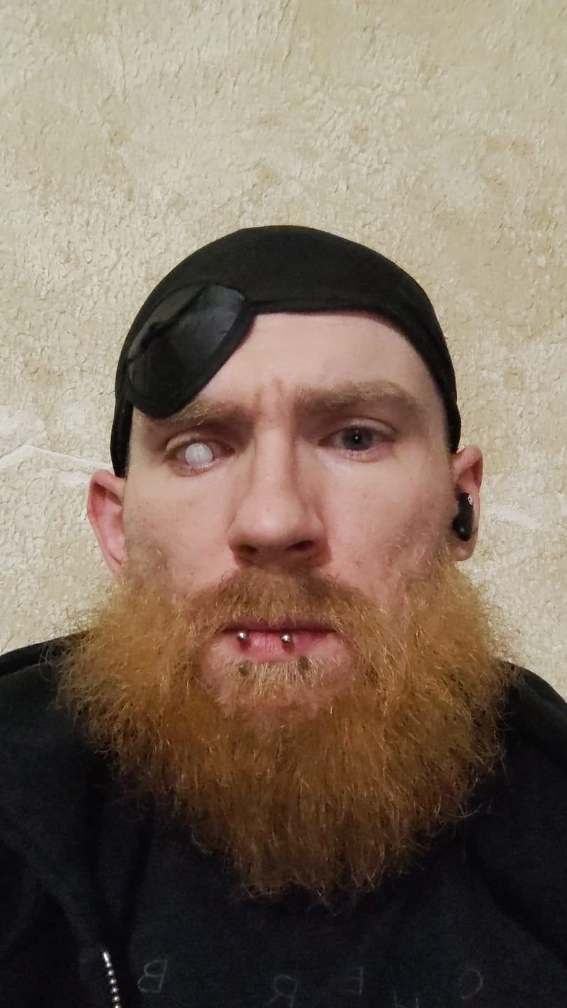 Customer photo review of Halloween White out Colored Contact Lenses