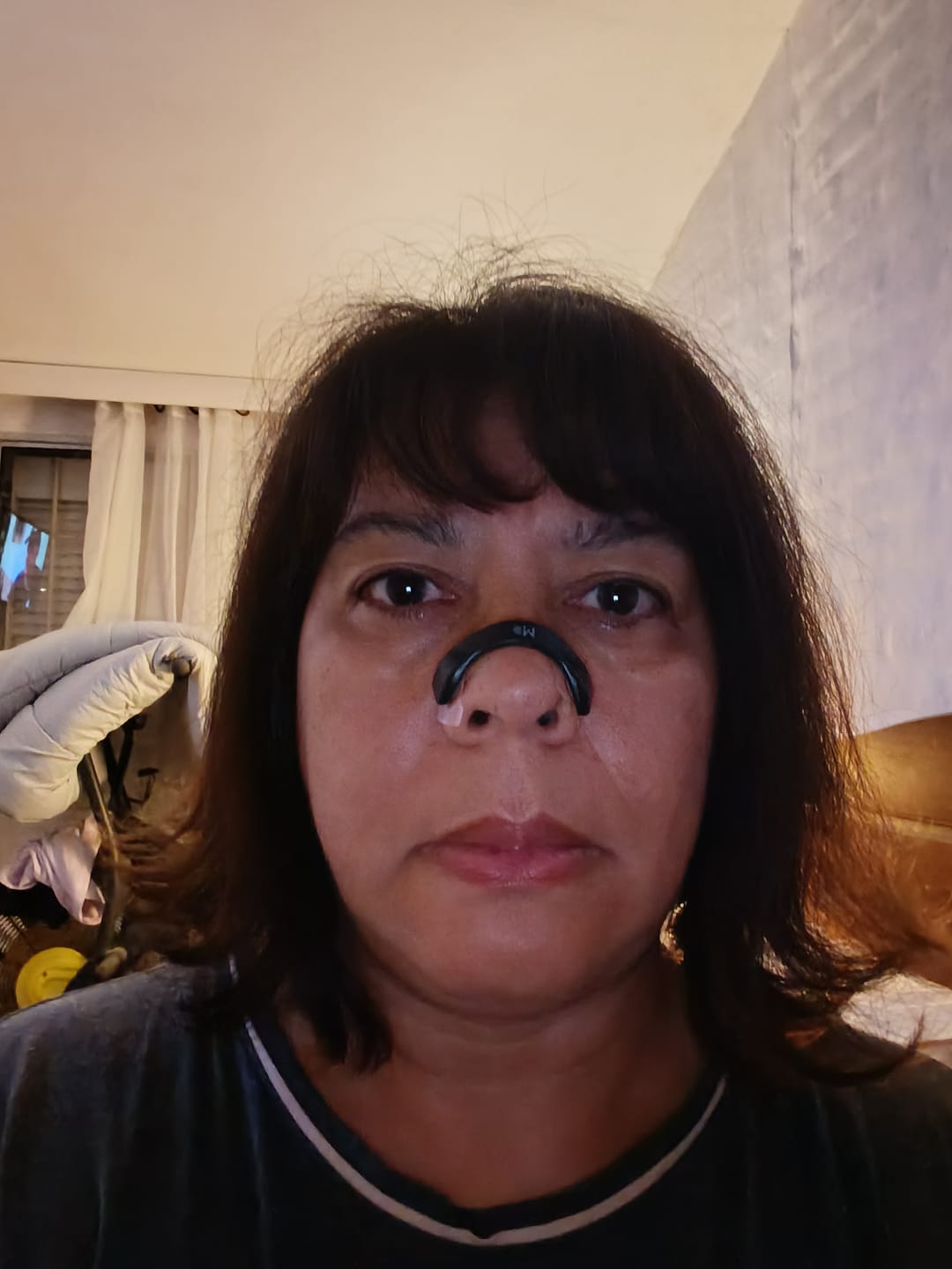 Customer photo review of Kit Magnetico de Respiración y Dilatador Nasal Milgenial