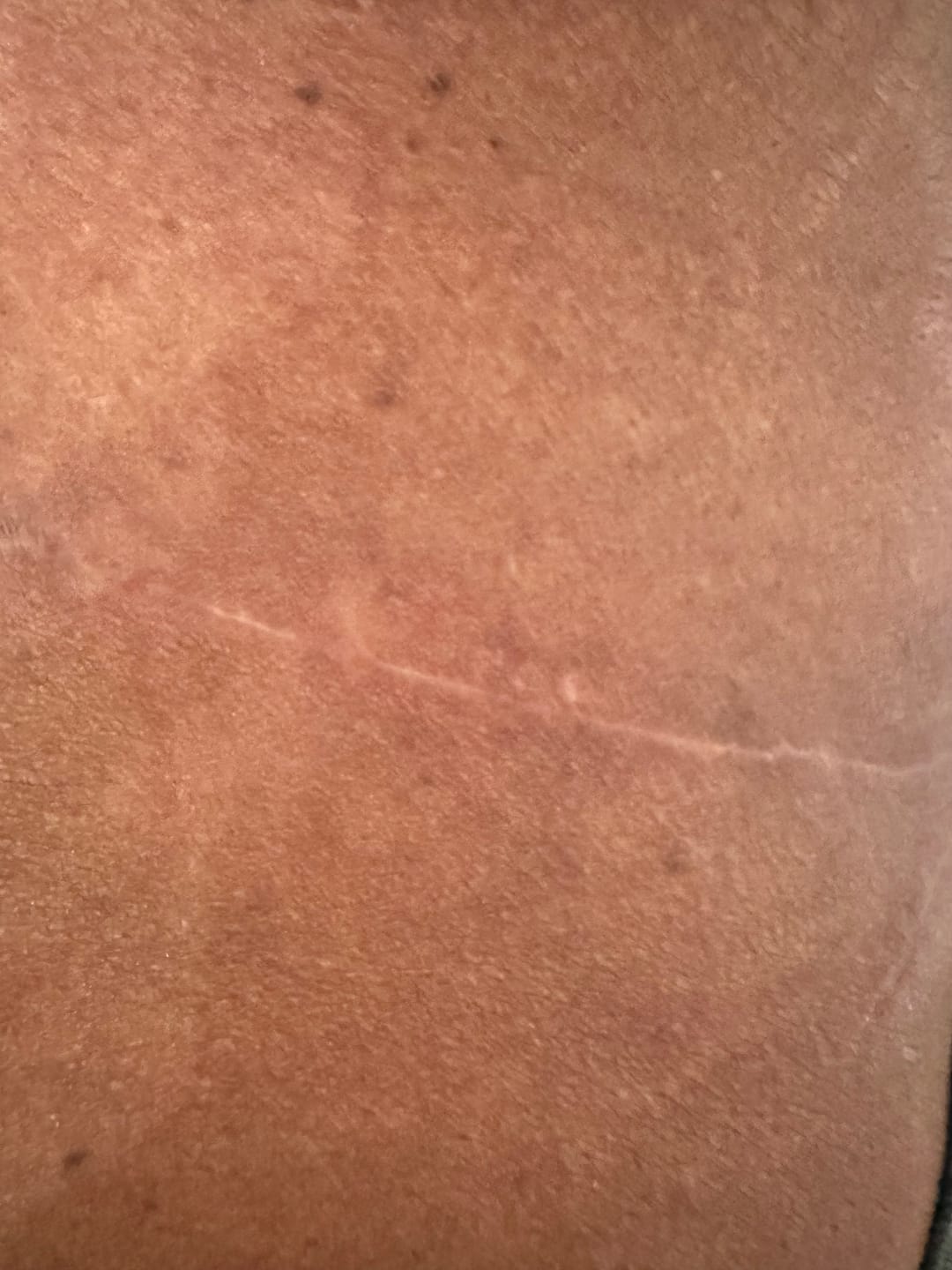 Customer photo review of Canibalm High Ointment