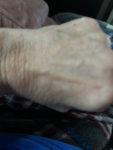 Close-up of a reviewer's wrinkled hand after using the Grass Fed Tallow & Honey Balm.