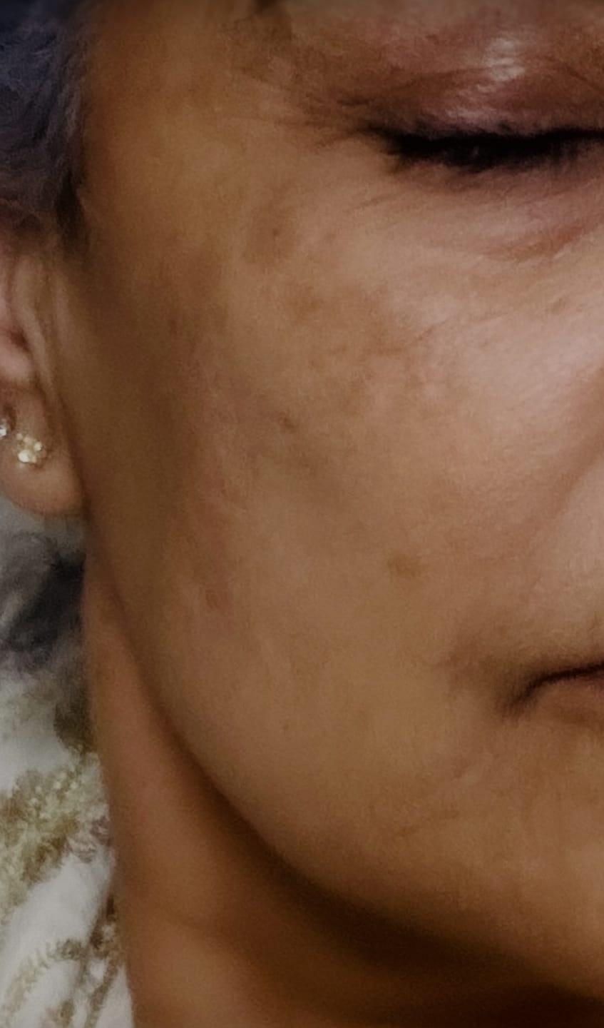 Customer photo review of Buy a Revitalizing Vitamin C Face Cream, Get a Free Vitamin C Serum