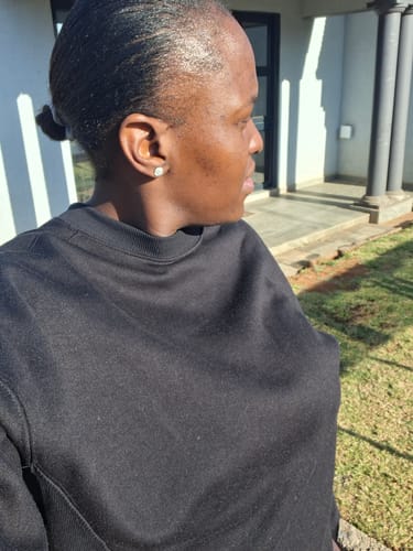 Customer photo review of Minoxidil High Strength (5%) SOLUTION, 3x60ml pack