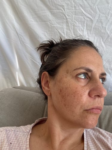 Close-up of a reviewer's face showing smooth skin after using the Sea Cucumber Collagen Trio Pack.