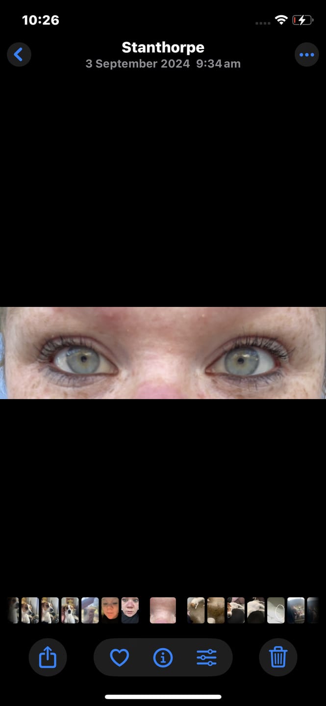 Customer photo review of LASH GROWTH SERUM