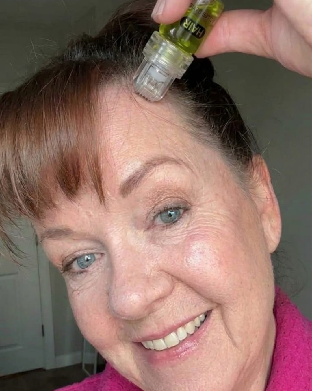 Customer photo review of Glow Drops™ Mikronadel Pflege Infusion
